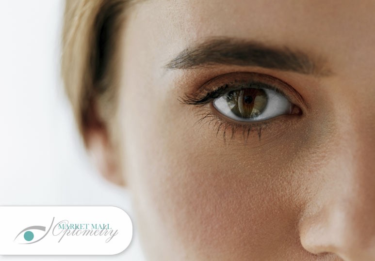 Calgary Diabetic Retinal Examination,Calgary Diabetic Retinal Exam