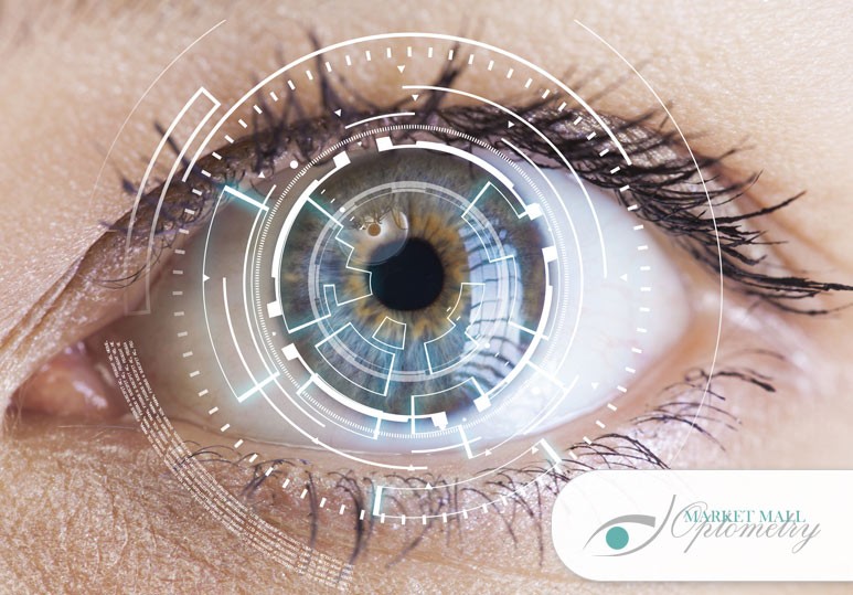 Market Mall Eye Exam