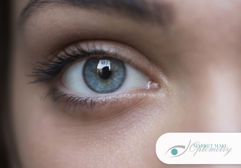 Calgary Diabetic Retinal Exam