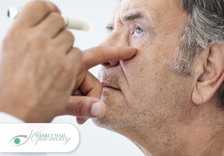 Cataract surgery, eye clinic Calgary, eye doctor Calgary