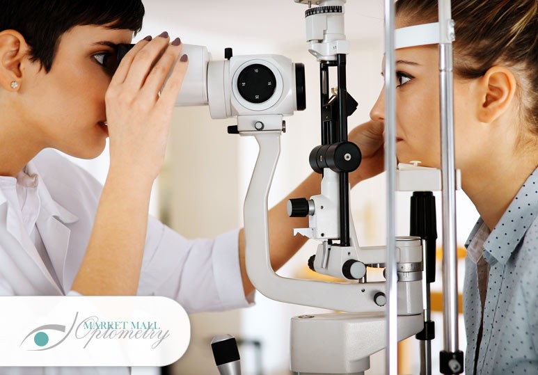 Free Eye Exam Calgary