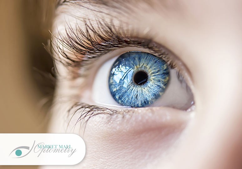 Eye Doctor Calgary NW, Optometrist Calgary NW